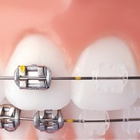 Medic Ortodont Constanta